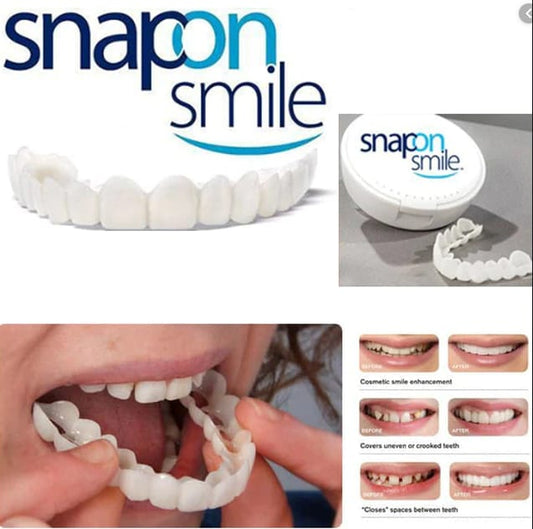 Silicone Imitation Braces – Snap-On Smile Decorative Fake Teeth Kit (Reusable & Safe)